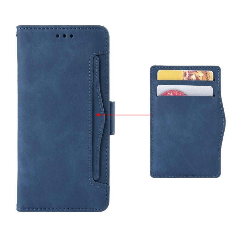 For Doogee N40 Pro Skin Feel Calf Pattern Horizontal Flip Leather Case with Holder & Card Slots & Photo Frame(Blue) - More Brand by buy2fix | Online Shopping UK | buy2fix